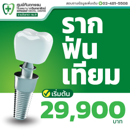รากฟันเทียม ทดแทนฟันแท้ได้อย่างเป็นธรรมชาติ